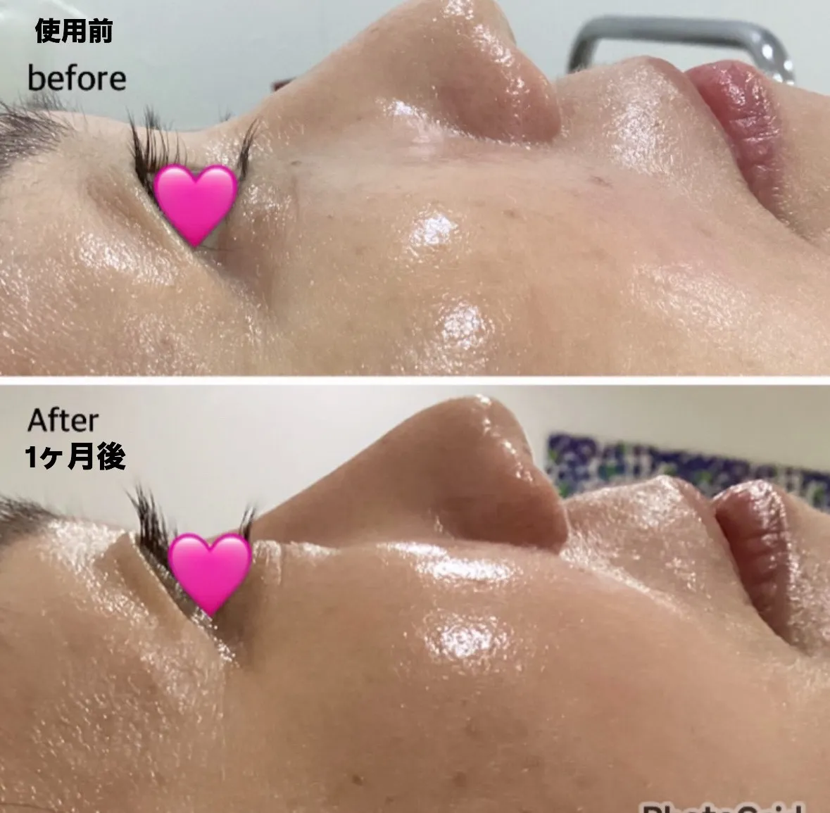 宮崎市エステ　まつ毛美容液　リバイタラッシュアドバンスプラス