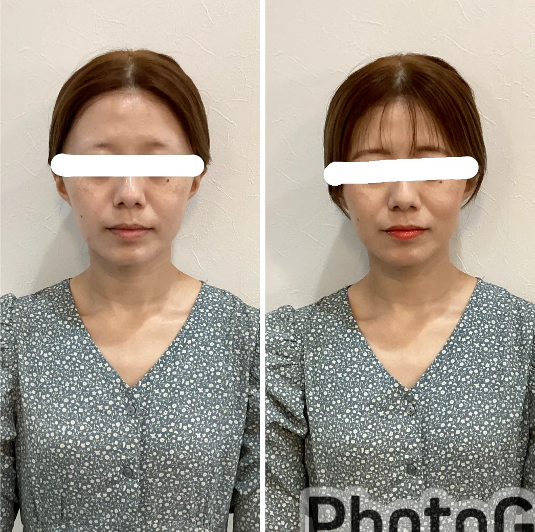 宮崎市エステ　ジェーンメイク