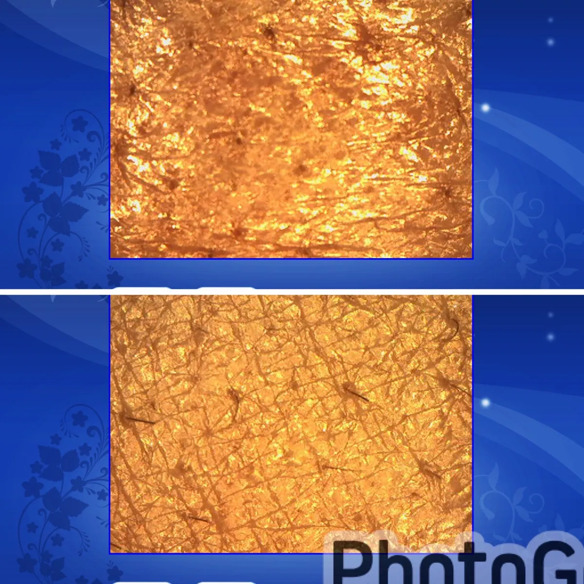 宮崎市エステ　毛穴洗浄