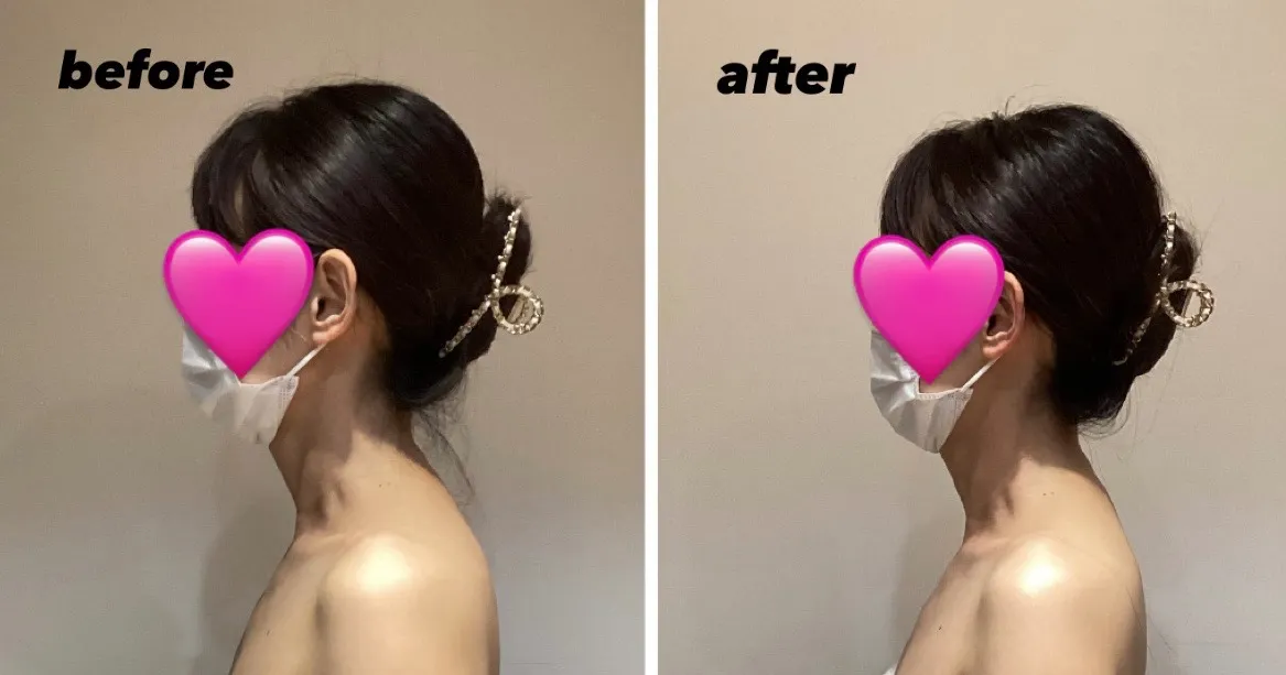 ビューティーネック✨️