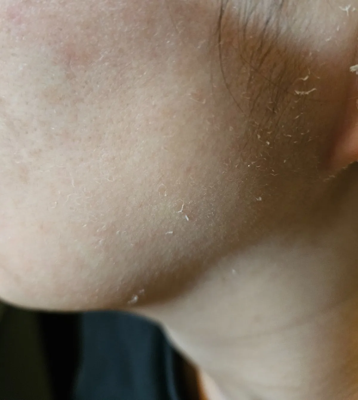 ゴールドセラム始めました！！