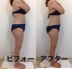 熊本市エステワム　お客様の結果ボディ　ブライダルや産後のスタイルアップにも