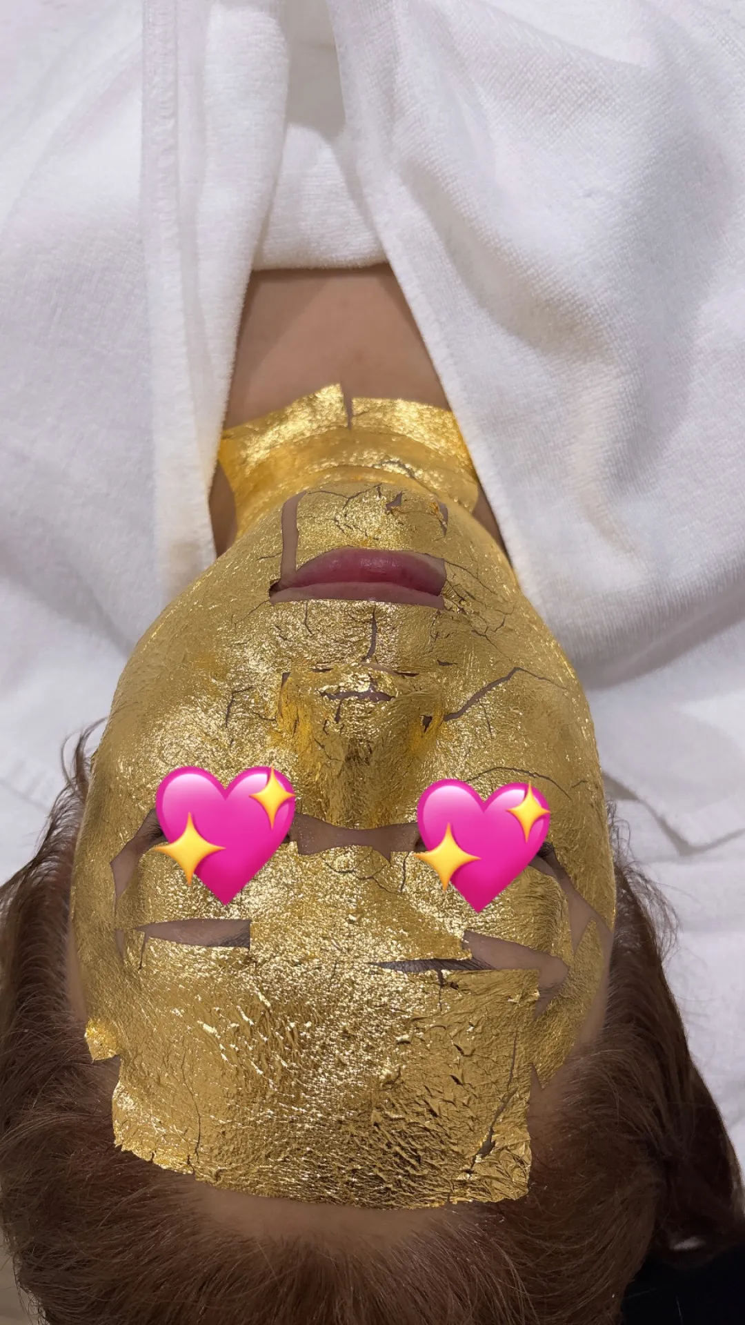 宮崎市エステ 24金美顔✨