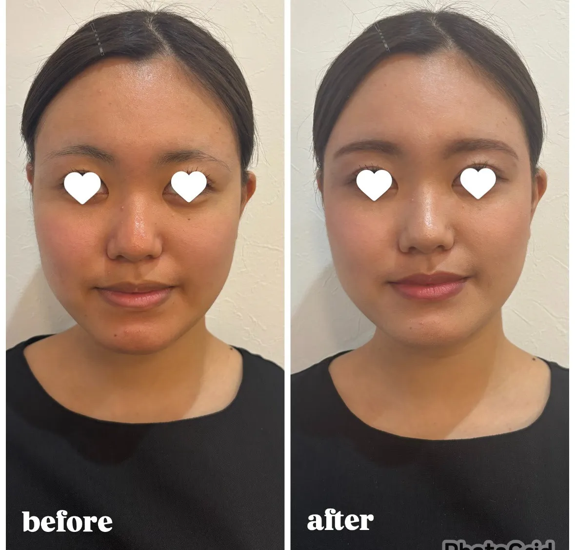 宮崎市エステ ジェーンメイク