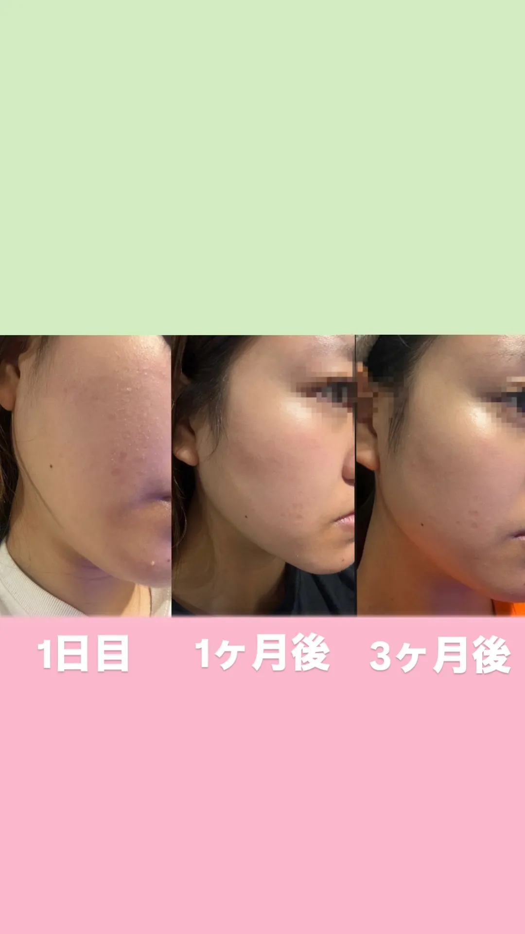 3ヶ月間　Be20シリーズ使ってみた結果....😳